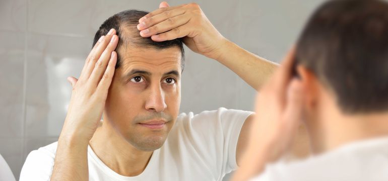 Finasteride reviews
