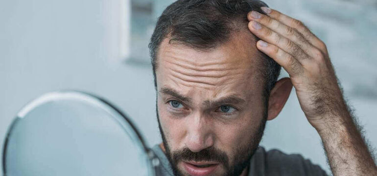 Finasteride vs Propecia
