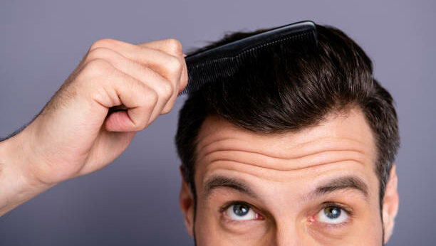 Topical Finasteride Vs Oral Finasteride